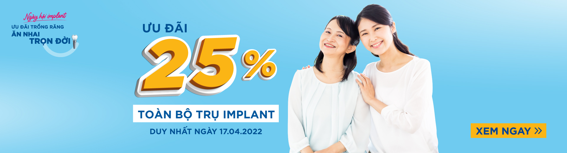 Cấy ghép implant mất bao lâu với công nghệ lành thương nhanh PRF