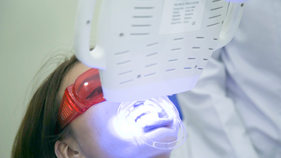 Công nghệ tẩy răng bằng laser là gì? Có tốt và hiệu quả không?