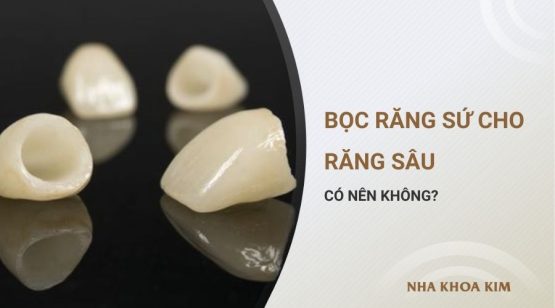 Có Nên Bọc Răng Sứ Cho Răng Sâu Không?