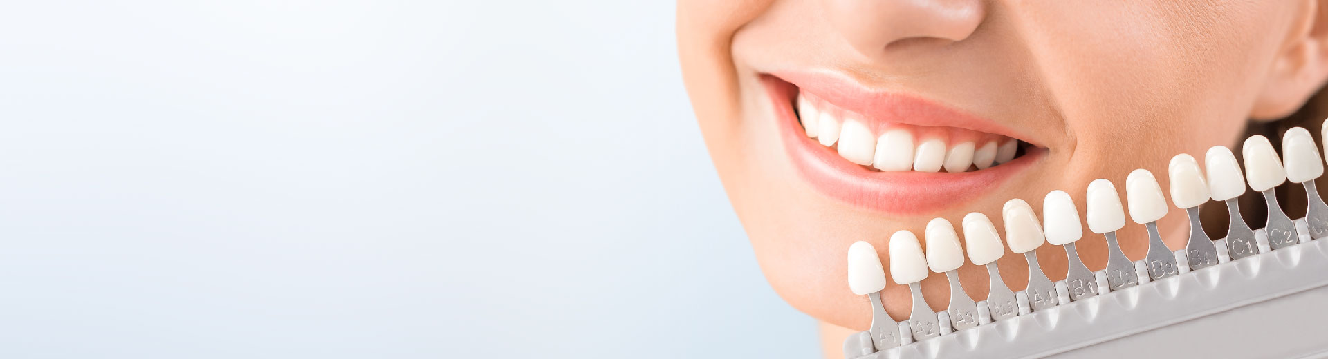 [Top Banner Desktop] Bọc răng sứ thẩm mỹ – Trường hợp nào nên thực hiện?