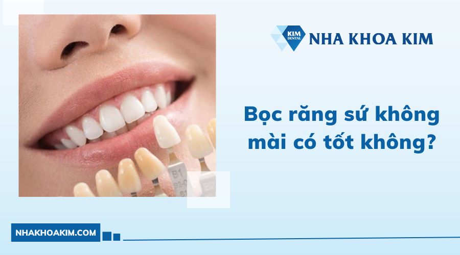 bọc răng sứ không mài có tốt không