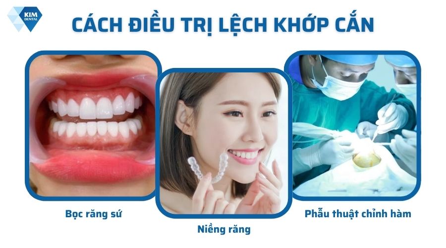 Bị lệch khớp cắn phải làm sao