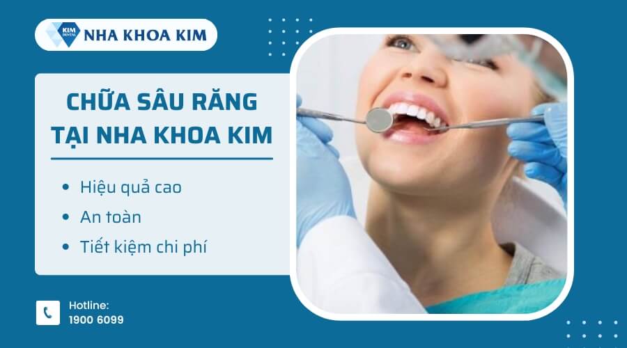 Chữa sâu răng hiệu quả cao, an toàn, tiết kiệm chi phí tại Nha Khoa Kim