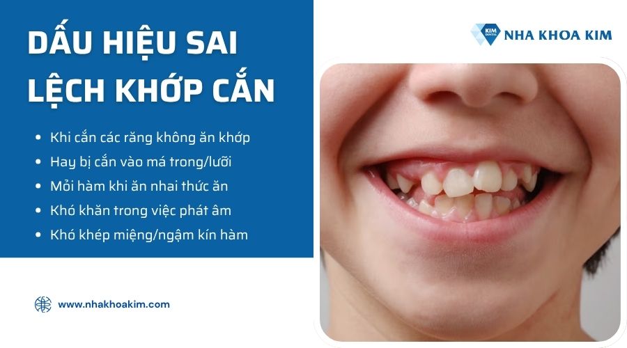 dấu hiệu khớp cắn bị lệch
