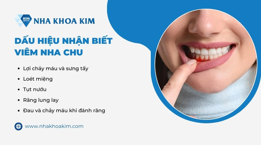 Dấu hiệu bệnh viêm nha chu