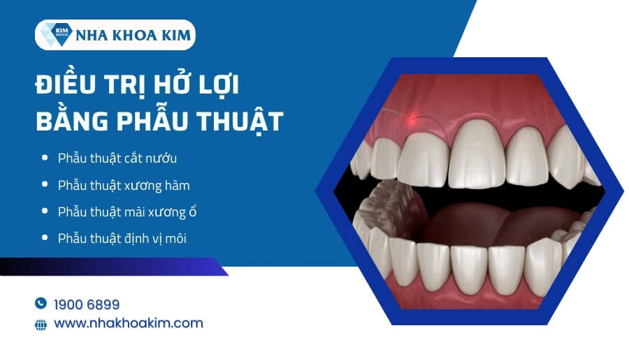 Điều trị hở lợi bằng phẫu thuật