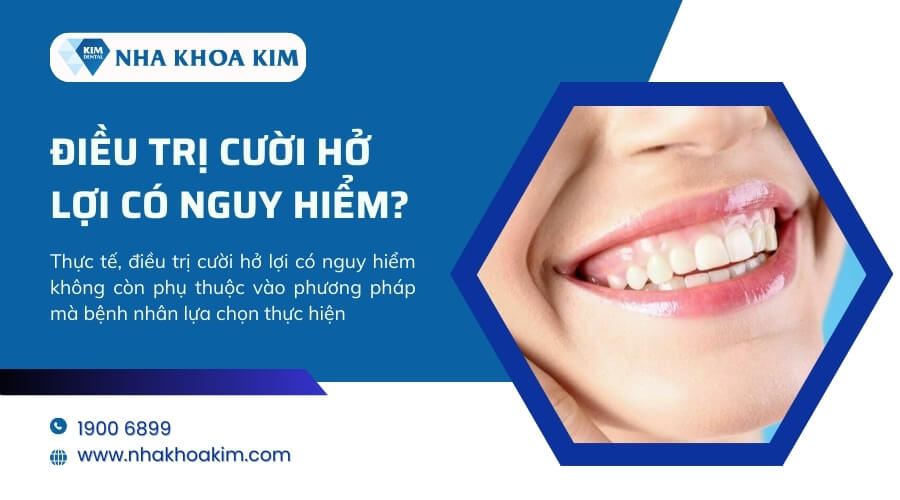 Những lưu ý khi điều trị cười hở lợi