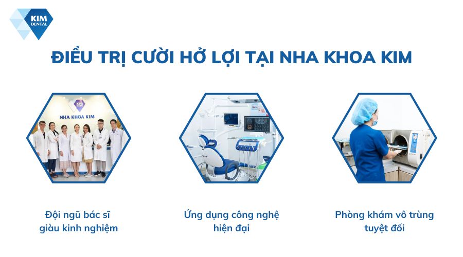 điều trị cười hở lợi tại nha khoa kim
