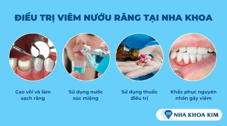 Cách điều trị viêm nướu răng tại nha khoa