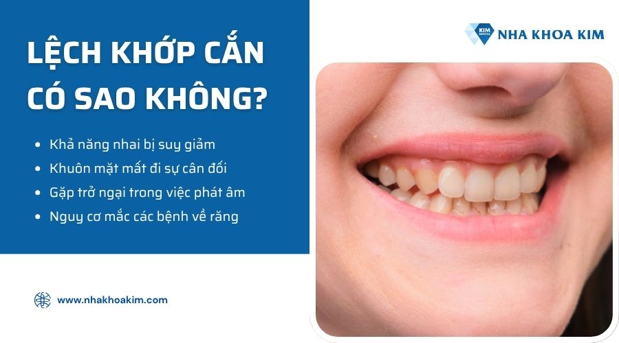 lệch khớp cắn có nguy hiểm không