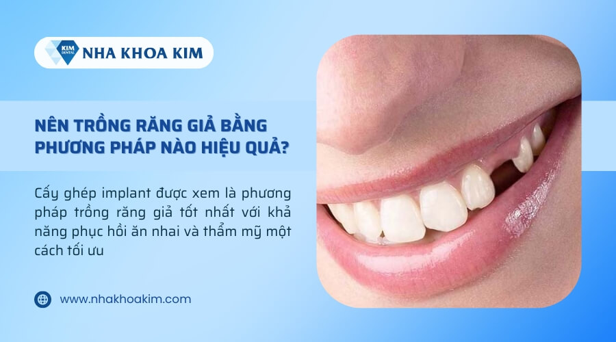 Nên trồng răng giả bằng phương pháp nào?