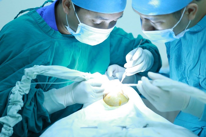 Giải phẫu cắt xương hàm hô móm | Nha khoa KIM 3