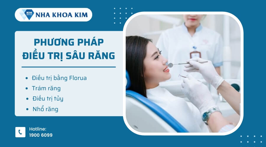 Các phương pháp điều trị sâu răng