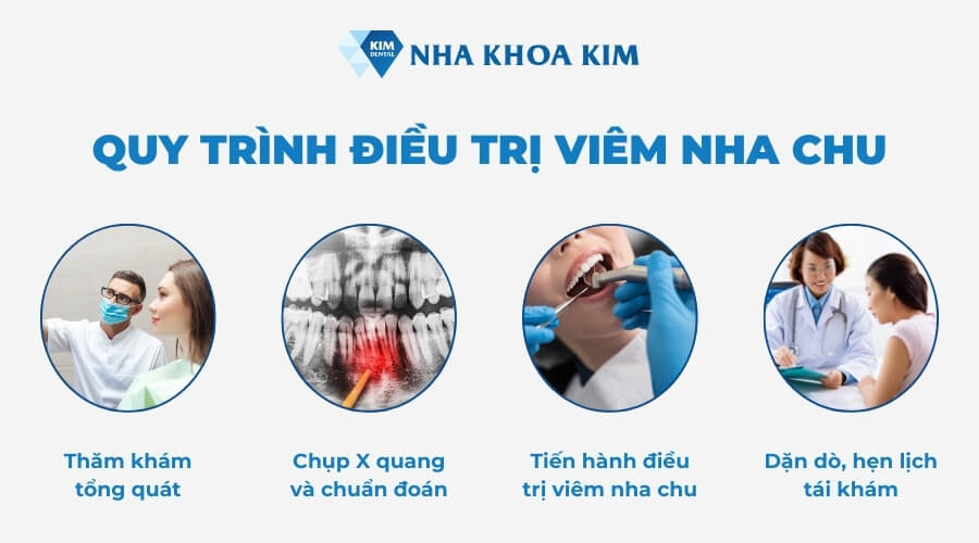 Quy trình điều trị viêm nha chu tại nha khoa