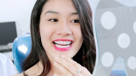 Nên chọn bọc răng sứ loại nào tốt, an toàn hiện nay?