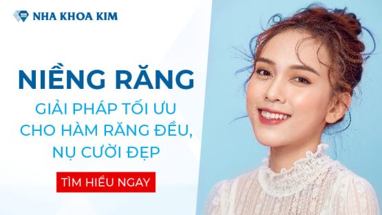 Niềng răng thẩm mỹ là gì? Những thông tin cần biết trước khi niềng