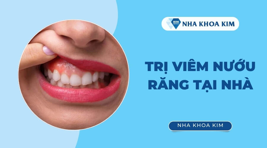 Cách trị viêm nướu răng tại nhà