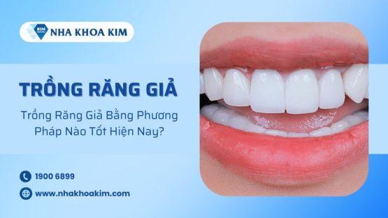 Trồng Răng Giả Bằng Phương Pháp Nào Tốt Hiện Nay?