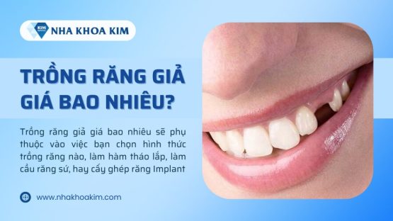 Giá làm răng giả khoảng bao nhiêu tiền? Thông tin chi tiết