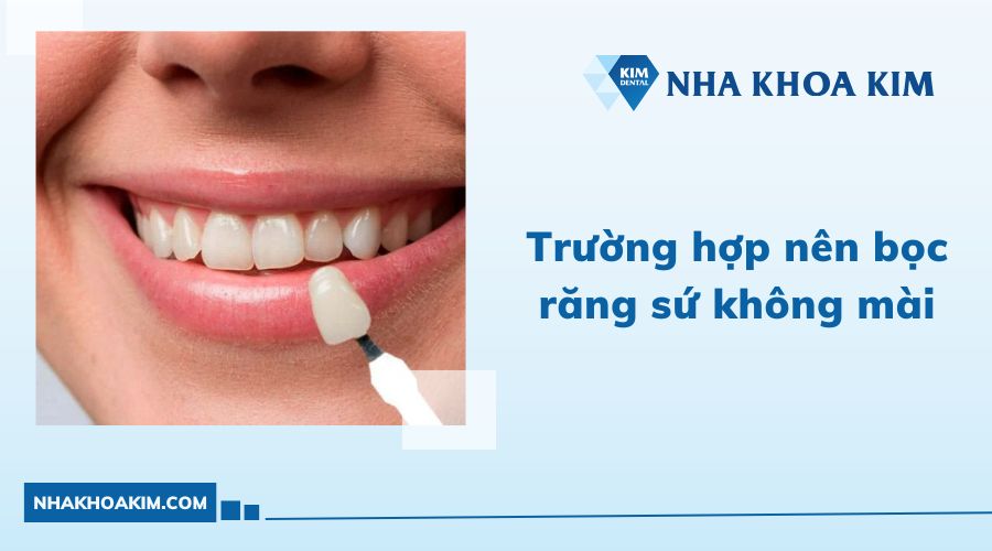 Trường hợp bọc răng sứ không mài