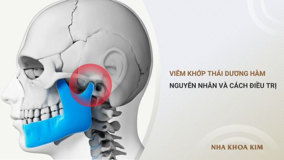 Viêm khớp thái dương hàm: Nguyên nhân và cách điều trị