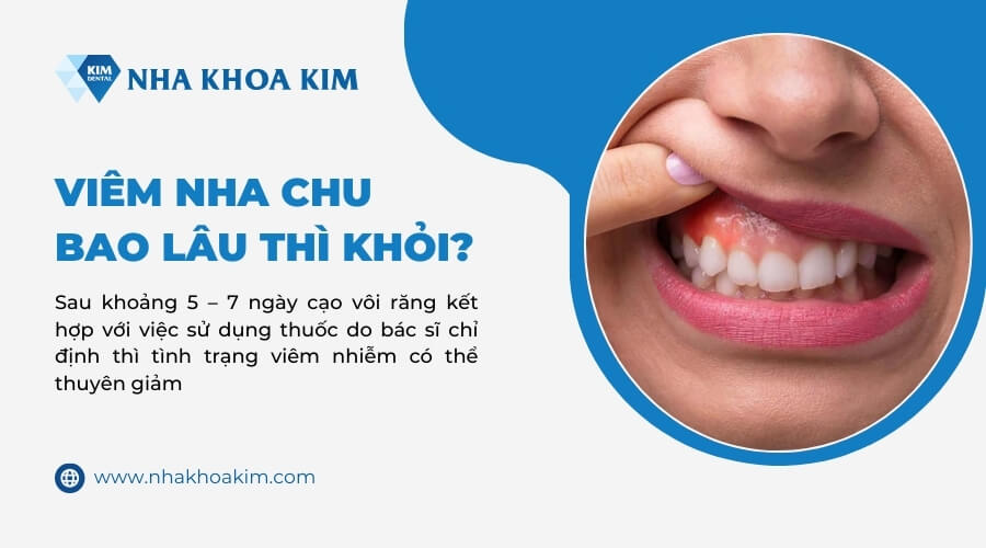 Viêm nha chu bao lâu thì khỏi?