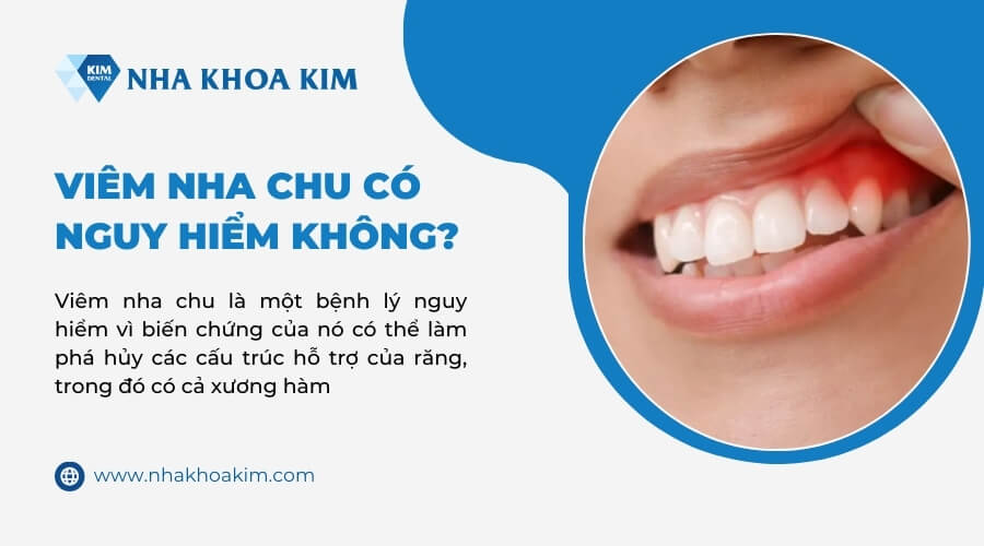 Viêm nha chu có nguy hiểm không?