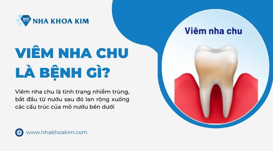 Viêm nha chu là bệnh gì?