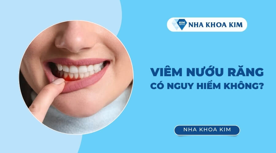 Viêm nướu răng có nguy hiểm không?