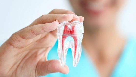 Điều trị tủy răng an toàn bằng công nghệ mới tân tiến