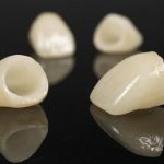 Bảng giá răng sứ zirconia áp dụng tại Nha khoa KIM Bảng giá răng sứ zirconia áp dụng tại Nha khoa KIM
