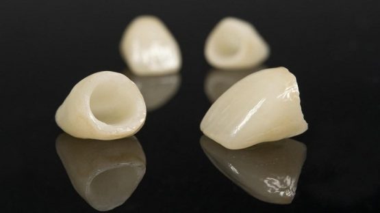 Bảng giá răng sứ Zirconia áp dụng tại Nha Khoa Kim