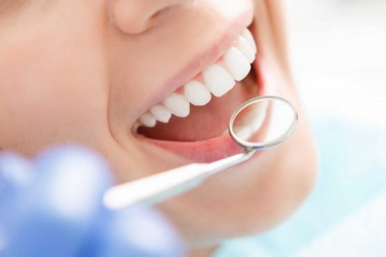 Bọc răng sứ cho răng thưa – Thông tin hữu ích bạn nên biết!