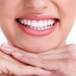 Cạo vôi răng - Giải pháp đơn giản giúp sở hữu hàm răng đều đẹp, chắc khỏe Cạo vôi răng - Giải pháp đơn giản giúp sở hữu hàm răng đều đẹp, chắc khỏe