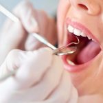 Cạo vôi răng ở đâu tốt, an toàn và hiệu quả? - Mách địa chỉ uy tín Cạo vôi răng ở đâu tốt, an toàn và hiệu quả? - Mách địa chỉ uy tín