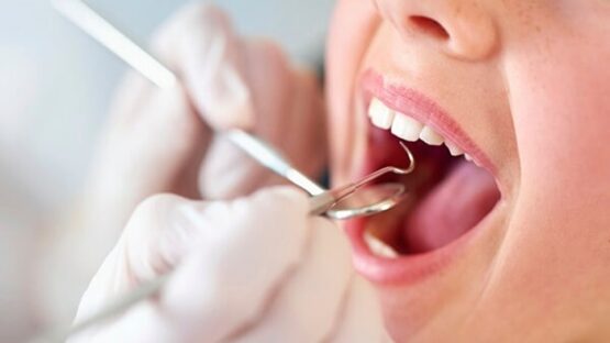 Địa chỉ cạo vôi răng ở đâu tốt, an toàn và hiệu quả?