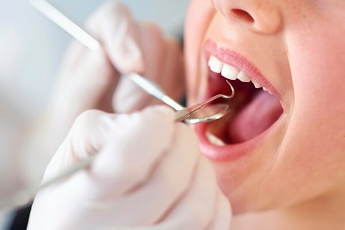 Hạn chế biến chứng xảy ra khi nhổ răng