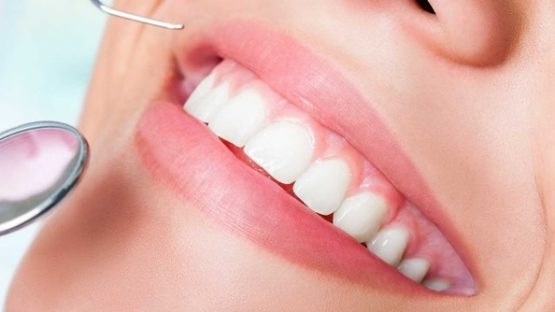 Bệnh viện bọc răng sứ nào uy tín, chất lượng điều trị tốt?
