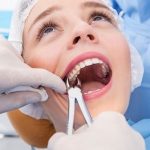 Nhổ răng có đau không - Làm sao để giảm đau hiệu quả Nhổ răng có đau không - Làm sao để giảm đau hiệu quả