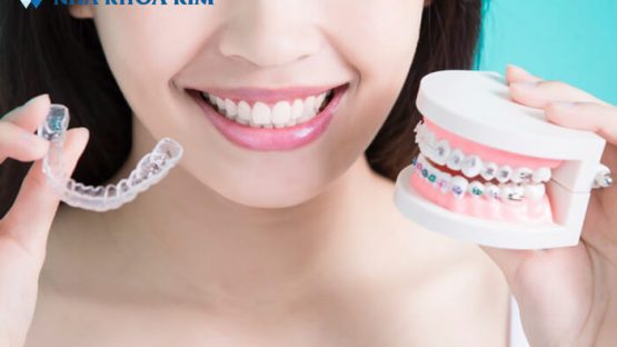 Nắn chỉnh răng là gì? Quy trình nắn chỉnh răng tại Nha Khoa Kim
