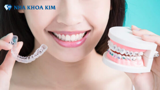 Nắn chỉnh răng là gì? Quy trình nắn chỉnh răng tại Nha Khoa Kim