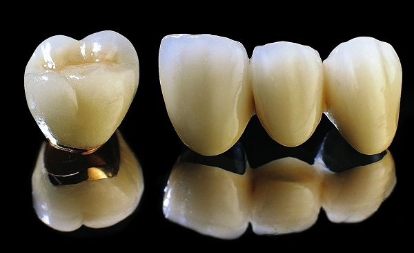 Răng giả làm bằng chất liệu gì?