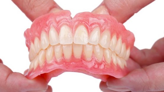 Răng giả tháo lắp – Giải pháp phục hình nhanh và tiết kiệm chi phí