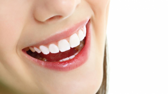 Tuổi thọ của răng sứ phụ thuộc vào những yếu tố nào?