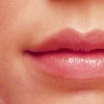 Tạo Khóe Miệng Cười - Giải Pháp Cho Khuôn Miệng Đẹp Thu Hút Hơn Tạo Khóe Miệng Cười - Giải Pháp Cho Khuôn Miệng Đẹp Thu Hút Hơn