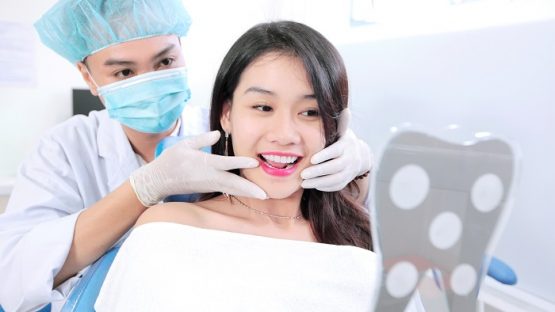 4 lợi ích khi bọc răng sứ tại Nha Khoa Kim