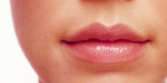 Tạo khóe miệng cười – Giải pháp cho khuôn miệng đẹp thu hút hơn