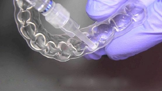 Tẩy răng bị nhiễm kháng sinh và cách khắc phục hiệu quả, an toàn
