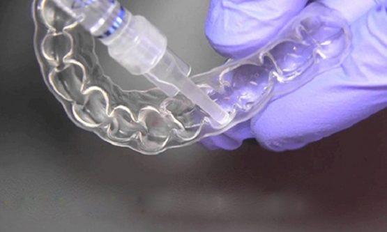 Tẩy răng bị nhiễm kháng sinh và cách khắc phục hiệu quả, an toàn
