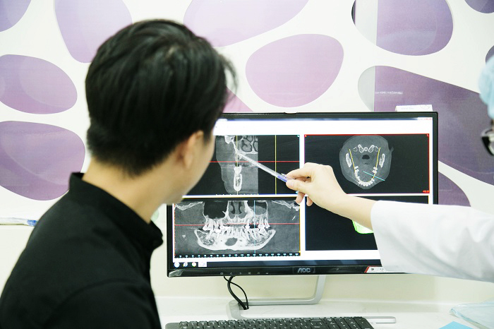 Địa chỉ trồng răng implant tại Hà Nội – Uy tín và chất lượng cao 8